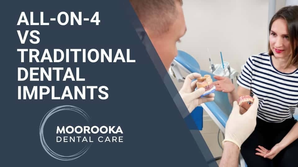 All On 4 Vs Traditional Dental Implants