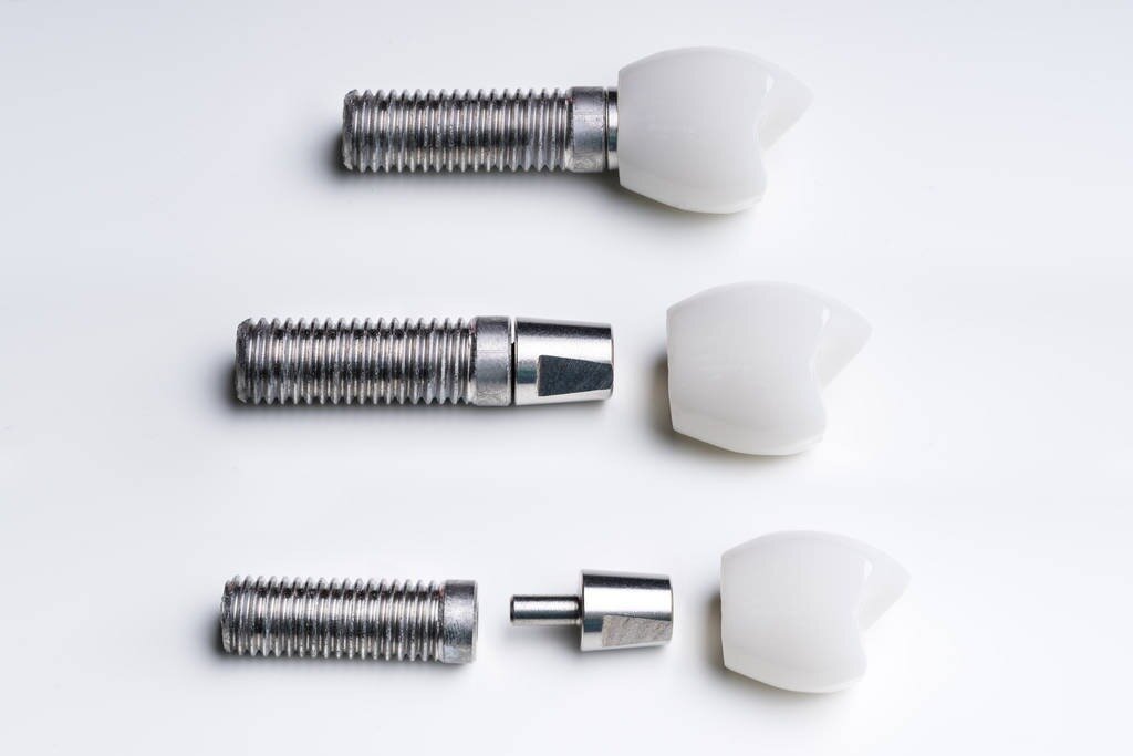 dental implant parts including the dental crown