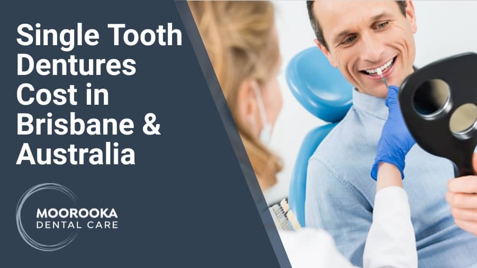Single Tooth Dentures Cost in Brisbane and Australia Moorooka Dental Care